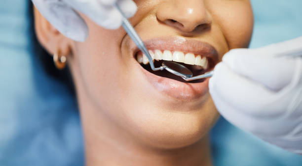 Best Emergency Treatment for Dental Infections or Abscesses in Hopewell, TN